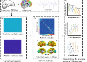 UM Research Reveals Connectome-Based Markers that Predict Subtypes of Frontotemporal Dementia