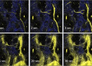 UM FHS develops innovative phosphorescence probes for precise tumour removal