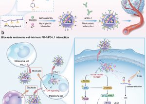 UM FHS's novel metal-polyphenol nanosystem strategy to combat malignant melanoma