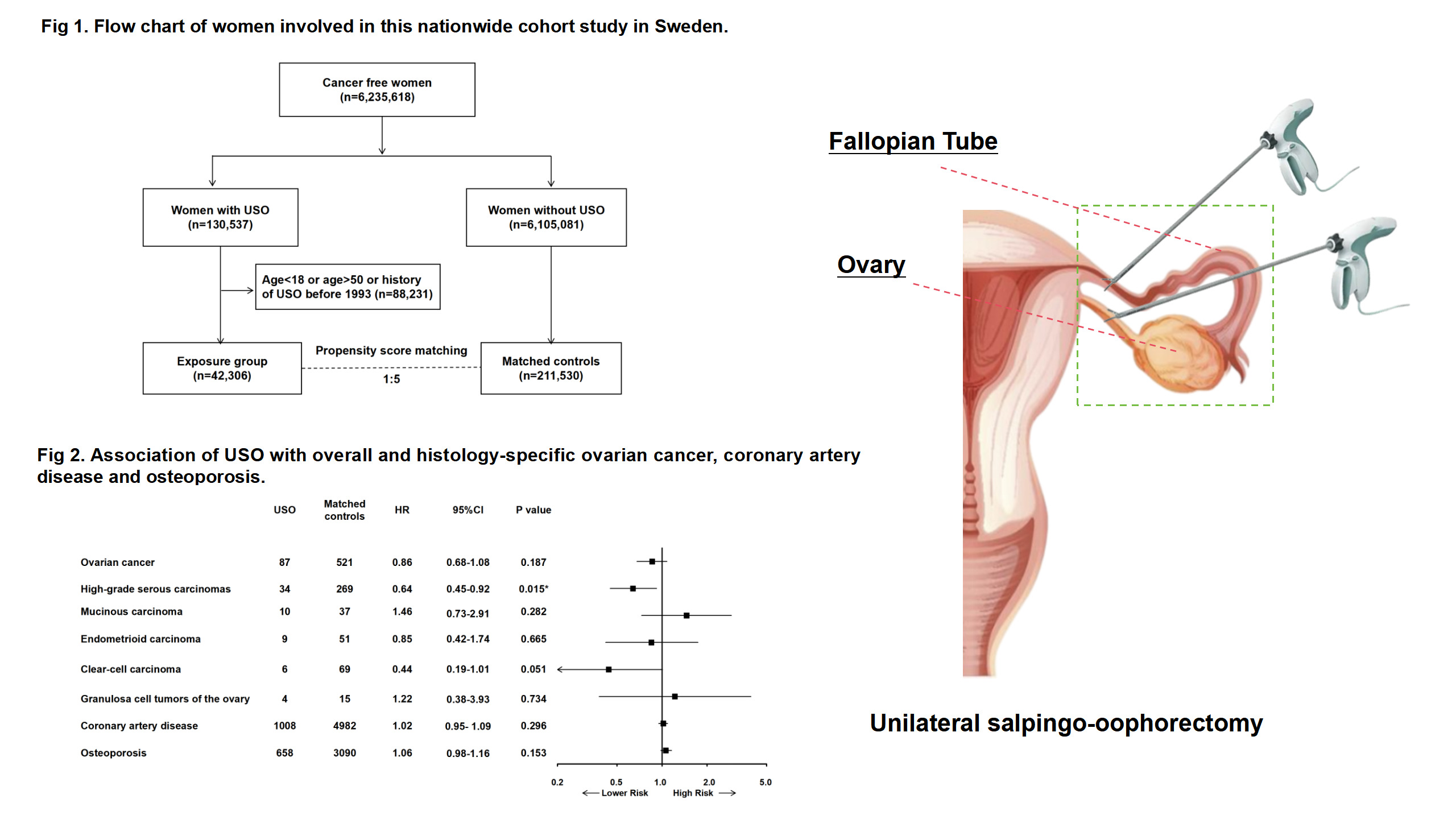 UM and international researchers discover risk-reducing potential of unilateral salpingo-oophorectomy for ovarian cancer